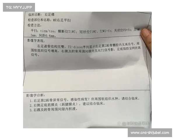 篮网八号秀杰明赛季报销 足底筋膜炎恶化影响重建进程